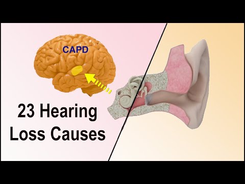 Sudden Hearing Loss Treatment